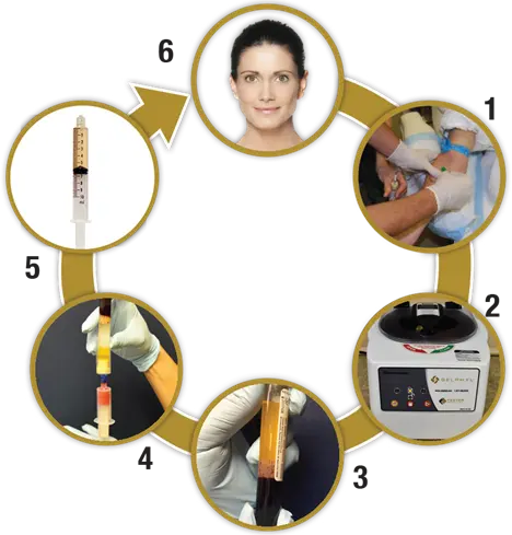 The Selphyl Process