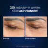 PCA SKIN Hyaluronic Acid Microneedle Eye Patches - Image 7