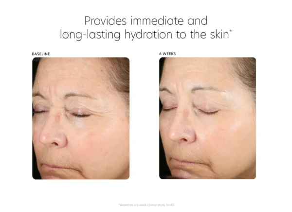 PCA SKIN Hyaluronic Acid Boosting Serum - Image 9