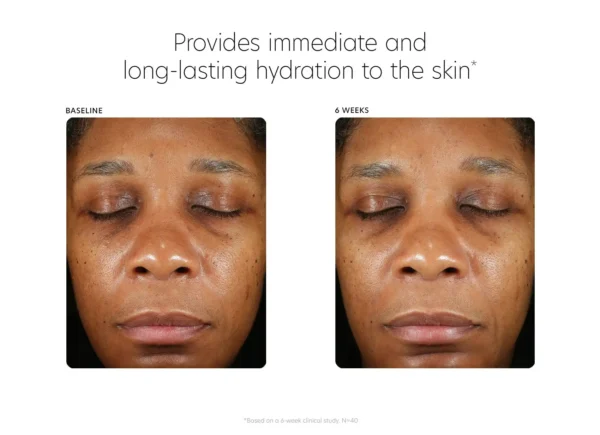 PCA SKIN Hyaluronic Acid Boosting Serum - Image 8