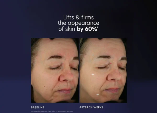 PCA SKIN Pro-Max Age Renewal - Image 7