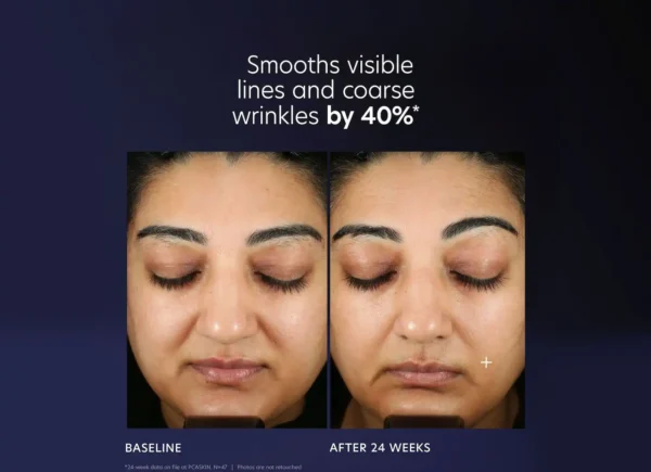 PCA SKIN Pro-Max Age Renewal - Image 9