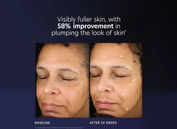 PCA SKIN Pro-Max Age Renewal - Image 8