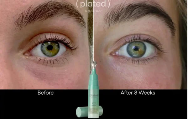 ( plated ) Skin Science EYE Serum - Image 7