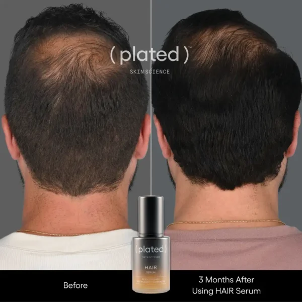 ( plated ) Skin Science HAIR Serum - Image 5