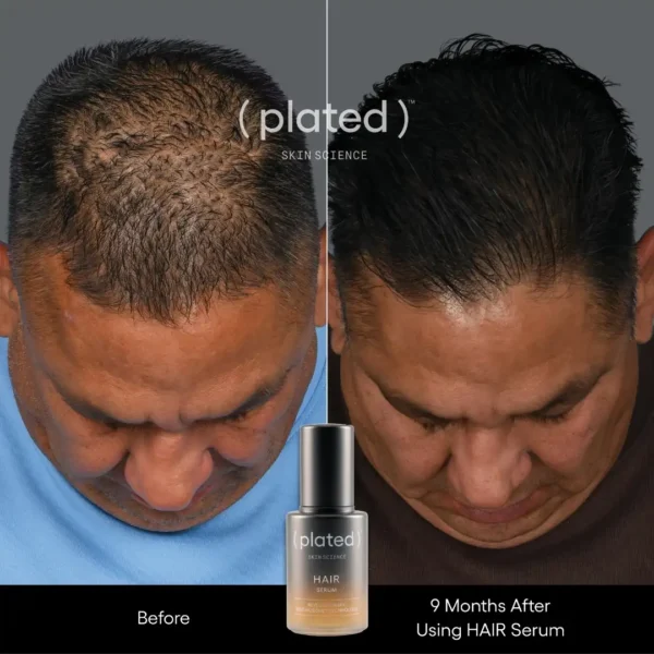 ( plated ) Skin Science HAIR Serum - Image 4