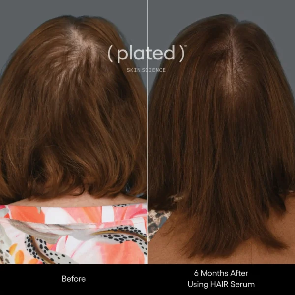 ( plated ) Skin Science HAIR Serum - Image 6
