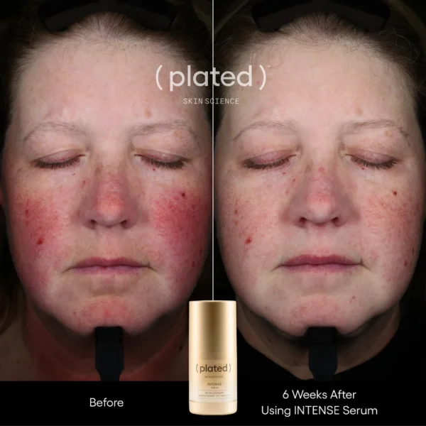 ( plated ) Skin Science INTENSE Serum - Image 4