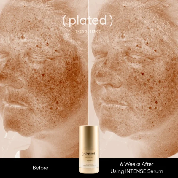 ( plated ) Skin Science INTENSE Serum - Image 5