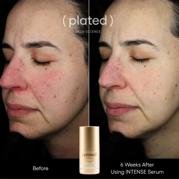 ( plated ) Skin Science INTENSE Serum - Image 3